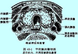 多內分泌腺衰竭綜合徵