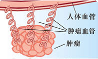 腫瘤血管