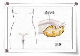 卵巢結構示意圖