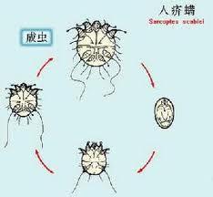 疥蟲檢查法