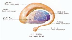 基底核鈣化症