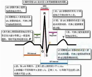 心電圖指標解釋