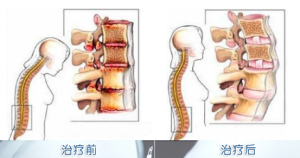 治療效果圖