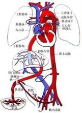 門靜脈血栓形成