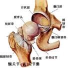 外傷型股骨頭壞死