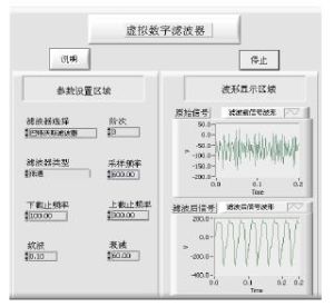 IIR數字濾波器