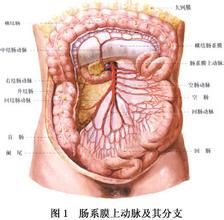 腸系膜上動脈栓塞