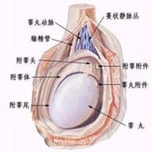 精索囊腫