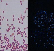 革蘭氏染色後發光菌對比暗室中菌落髮光