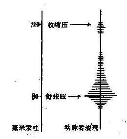 收縮壓