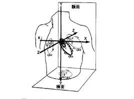 心電向量