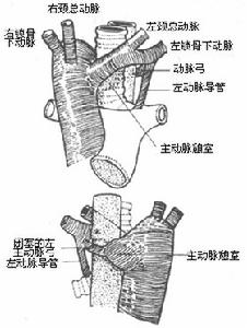 主動脈瓣膜部狹窄