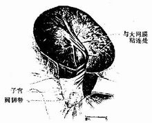 己烯雌酚 不良反應