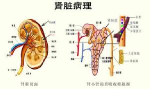 放射性腎炎