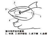 卡耳療法