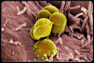 顯微鏡下的淋病奈瑟菌
