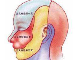 閃電樣痛