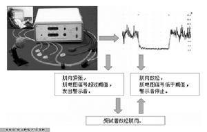 生物反饋法