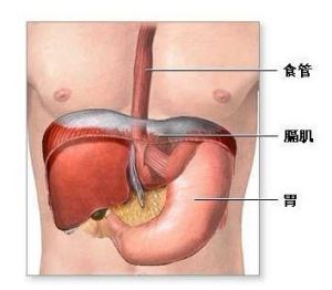 頑固性呃逆