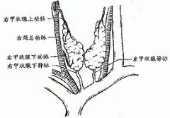 亞臨床甲亢