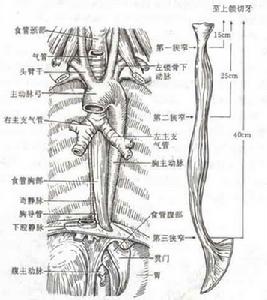 急性腐蝕性食管炎