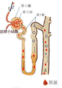 膜增殖性腎小球腎炎