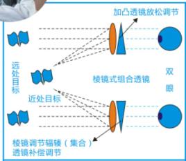 棱透組合鏡片預防近視研究