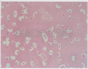 氣單胞菌肺炎
