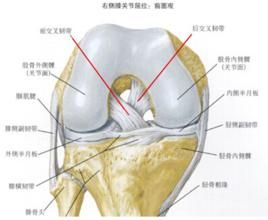 前十字韌帶損傷