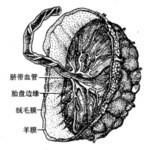 球拍狀胎盤