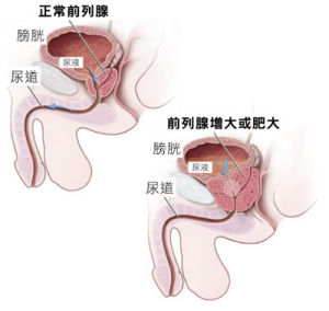 尿流動力學