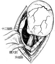 分離腎門