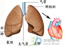 肺心病