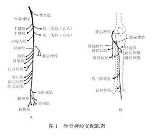 坐骨神經損傷