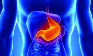 胃腸間質瘤