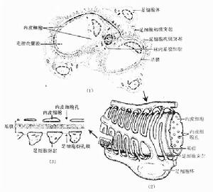 系膜毛細血管增生性腎炎