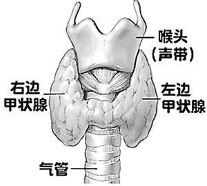 亞臨床甲減