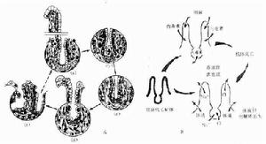 心肌疾病