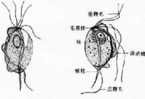 男性滴蟲病