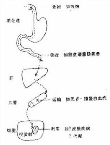 維生素A缺乏神經病