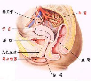 盆腔淤血綜合症