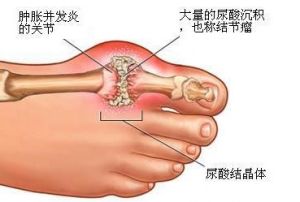 通風的症狀