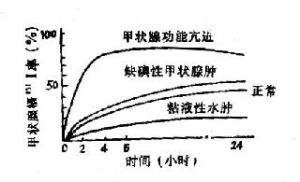 垂體興奮試驗