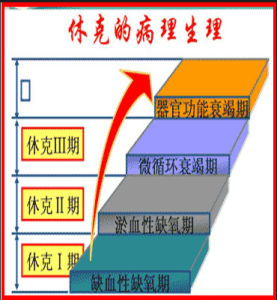 失血性休克