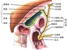 壺腹周圍癌