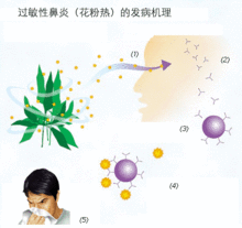 過敏性鼻炎的發病機理