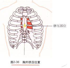 胸外心臟擠壓