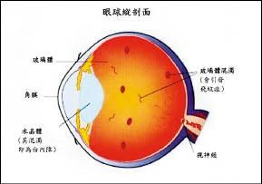 飛蚊症