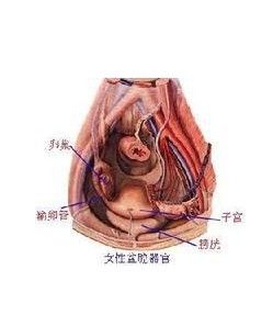 盆腔粘連