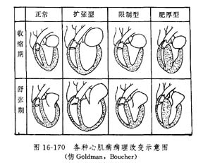 地方性心肌病